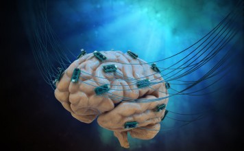 Human brain connected to cables and computer chips