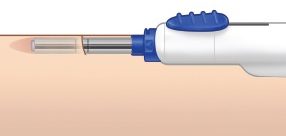 Техника под кожей: обзор импланта для мониторинга уровня сахара в крови Eversense