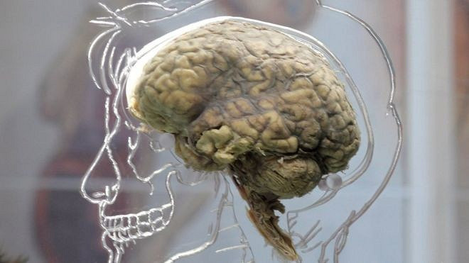 Резервное копирование мозга станет реальностью?