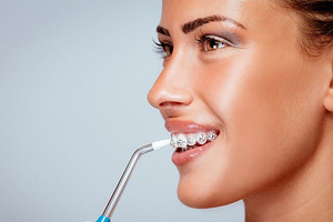 Ирригаторы для полости рта: как выбрать правильно