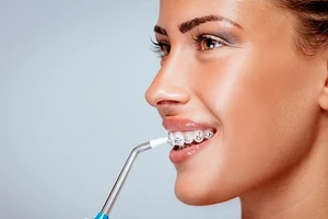 Ирригаторы для полости рта: как выбрать правильно