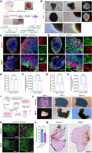 В Китае заморозили мозг человека, а затем разморозили через 1,5 года
