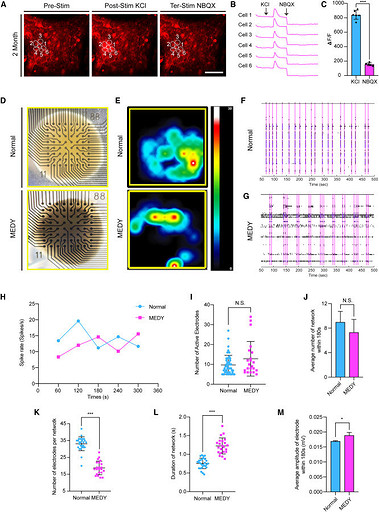 В Китае заморозили мозг человека, а затем разморозили через 1,5 года