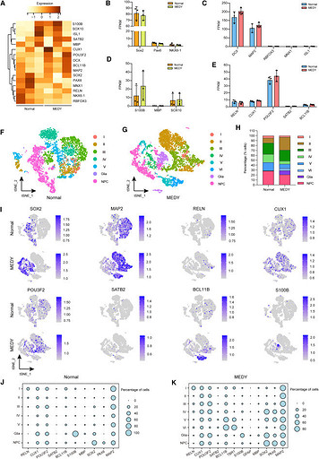 В Китае заморозили мозг человека, а затем разморозили через 1,5 года