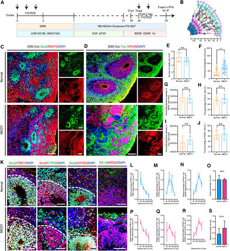 В Китае заморозили мозг человека, а затем разморозили через 1,5 года