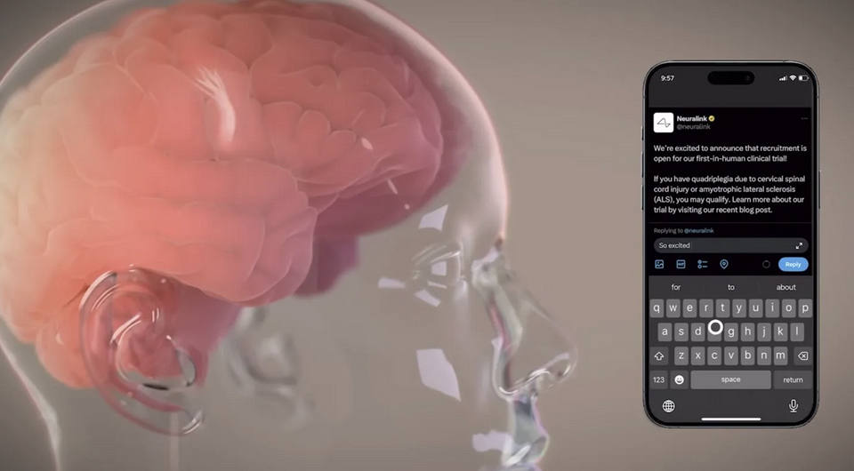 Илон Маск уверен, что в будущем смартфоны исчезнут — их заменят мозговые чипы Neuralink